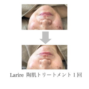 月に一度の至福の時間